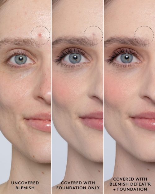 FS484174 Global Blemish Defeatr Infographics BEFORE AFTER BRIDGET 1200x1500 72DPI