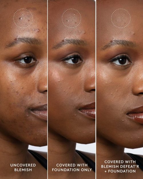 FS484174 Global Blemish Defeatr Infographics BEFORE AFTER CHRISTIANA 1200x1500 72DPI